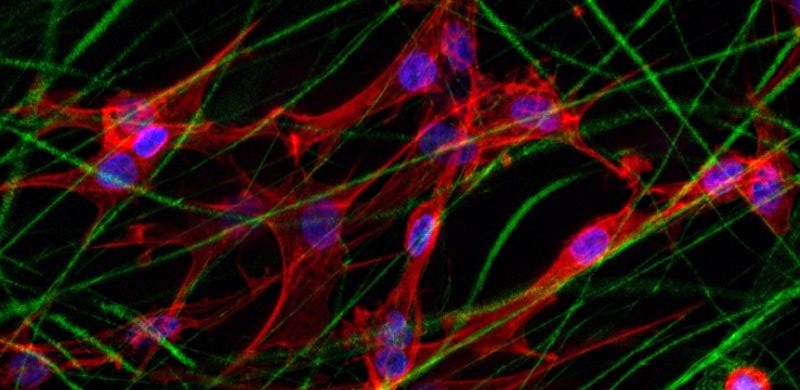 how can the cytoskeleton of a cell be described how can the cytoskeleton of a cell be described
